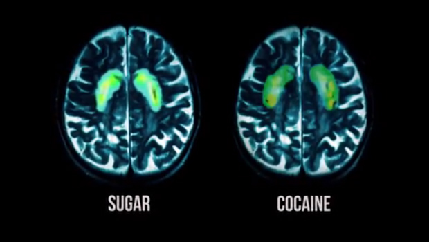 A brain on cocaine and a brain on sugar.